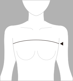 上胸囲（じょうきょうい）