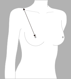 乳下がり（ちちさがり）